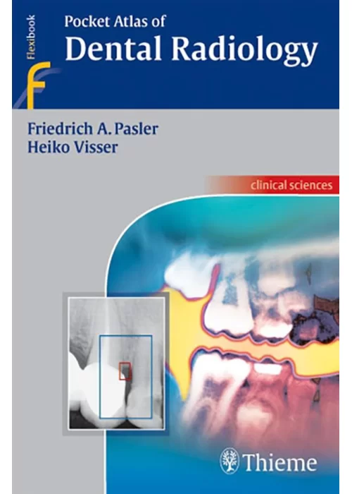 Pocket Atlas of Dental Radiology