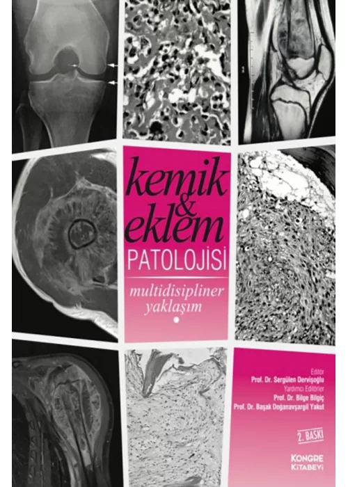 Kemik ve Eklem Patolojisi Multidisipliner Yaklaşım