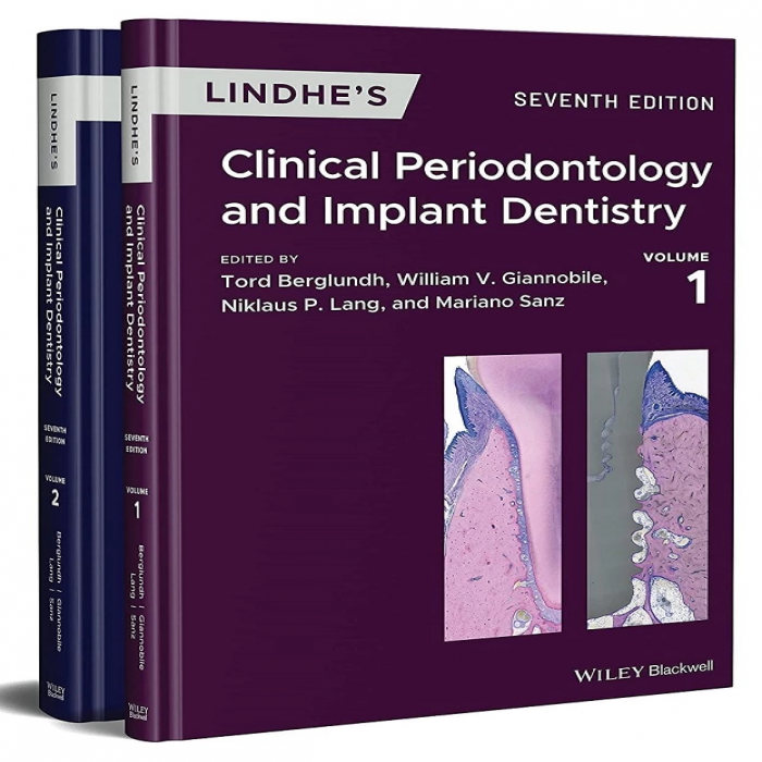 Ｐｅｒｉｏｄｏｎｔｉｃｓ ２ Lindhe's Clinical Periodontology and Implant Dentistry, 2