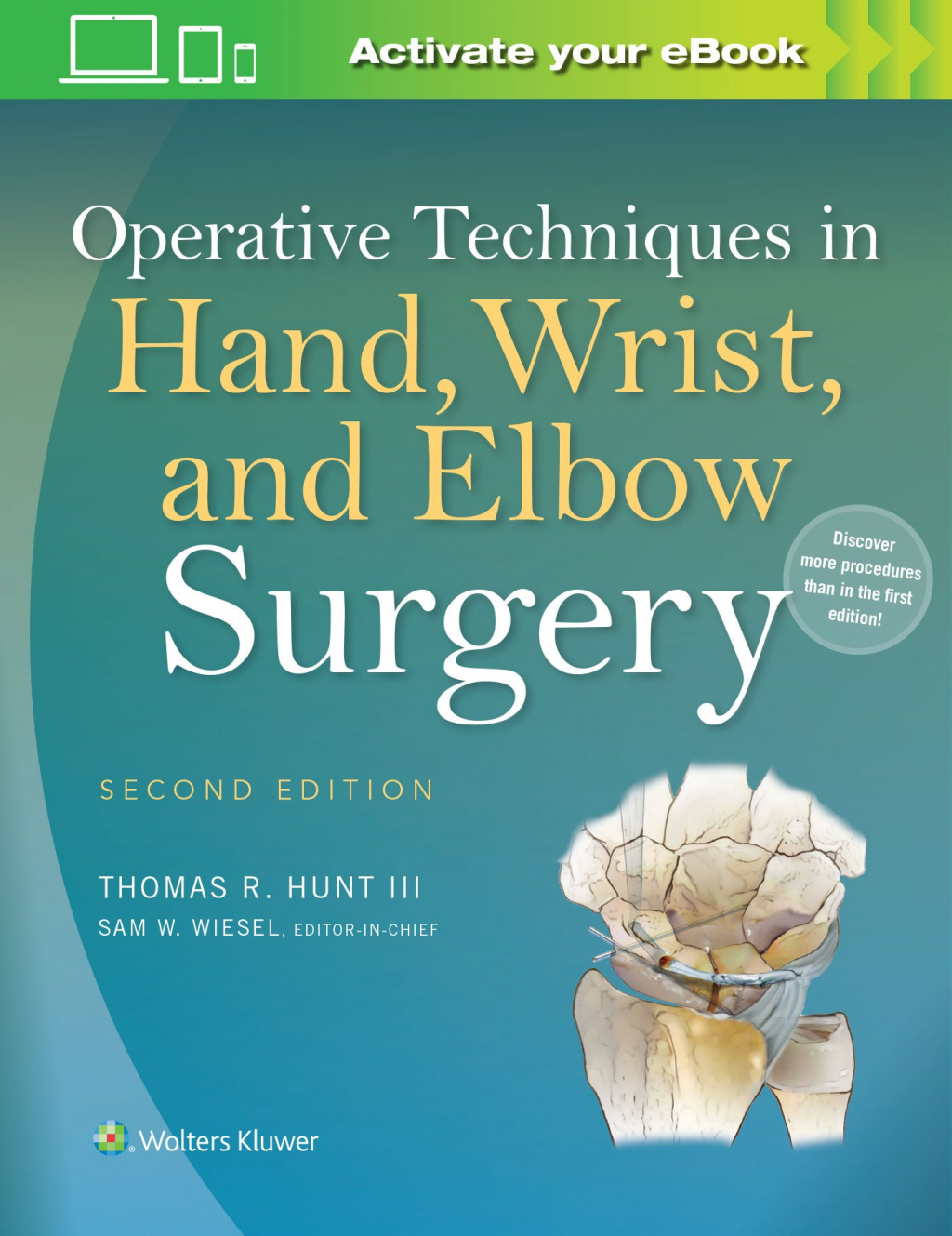 Operative Techniques in Hand, Wrist, and Elbow Surgery 9781451193053