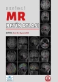Resimli MR Beyin Atlası