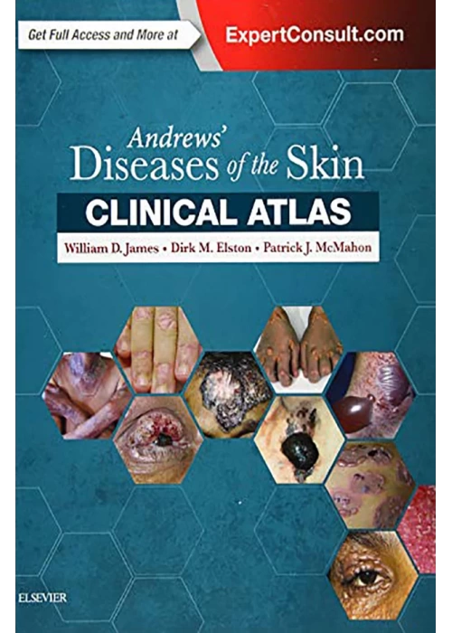 Andrews Diseases of the Skin Clinical Atlas