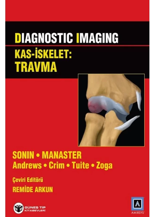 Diagnostic Imaging - Kas İskelet: Travma