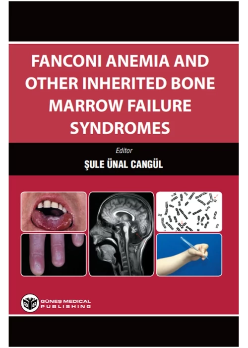 Fanconi Anemia And Other Inherited Bone Marrow Failure Syndromes