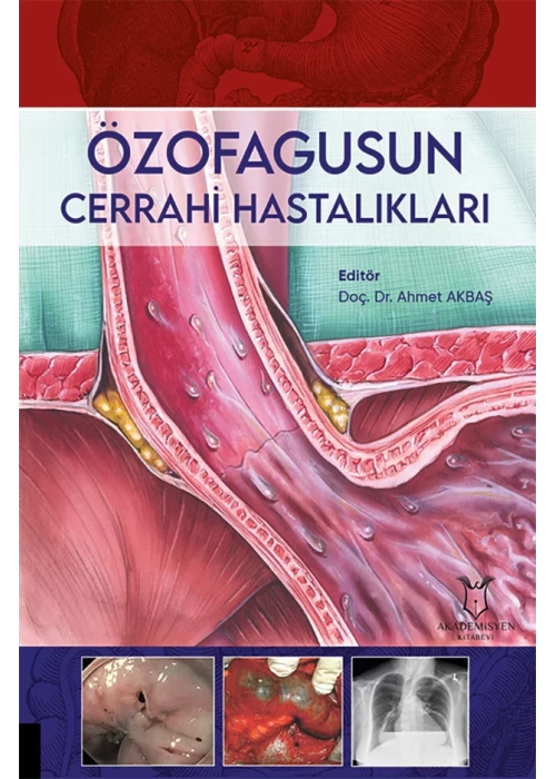 Özofagusun Cerrahi Hastalıkları