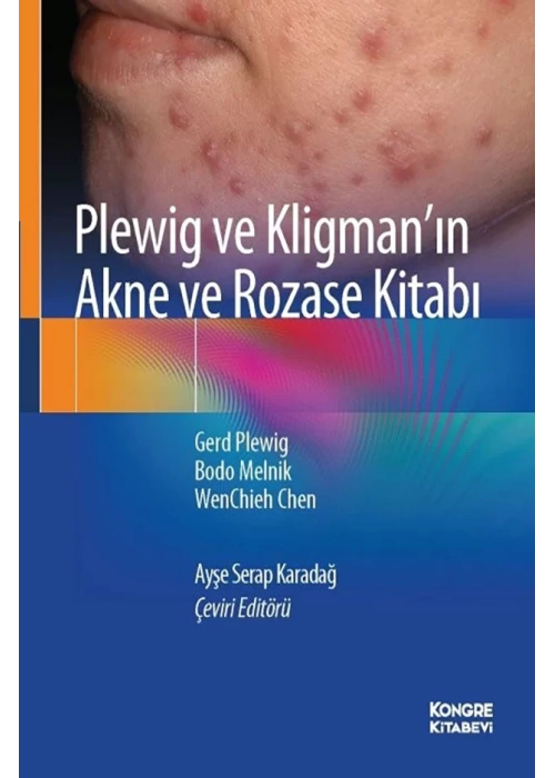 Plewig ve Kligmanın Akne ve Rozase Kitabı
