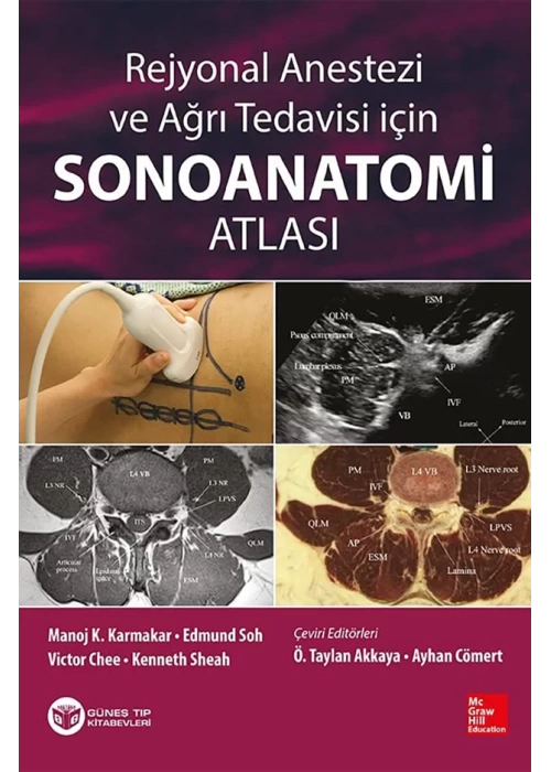 Rejyonal Anestezi ve Ağrı Tedavisi İçin Sonoanatomi Atlası