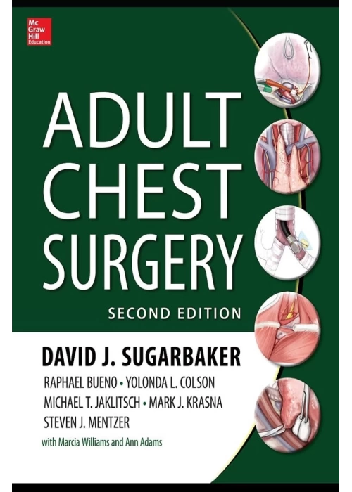 Adult Chest Surgery, 2nd edition