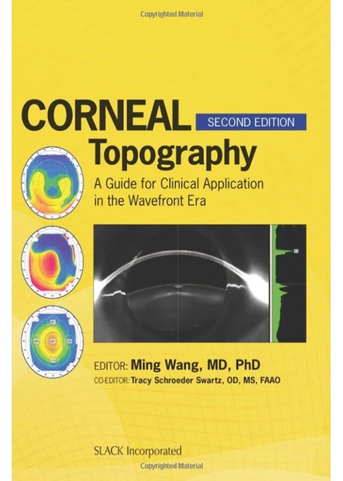 Corneal Topography: A Guide for Clinical Application in Wavefront Era