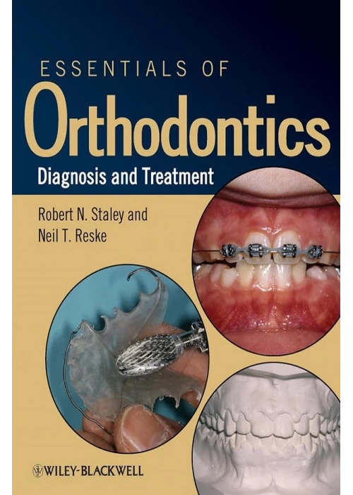 Essentials of Orthodontics: Diagnosis and Treatment