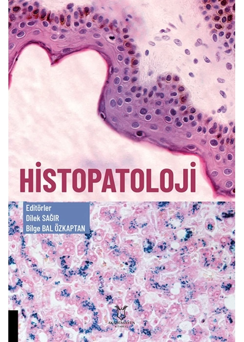 Histopatoloji