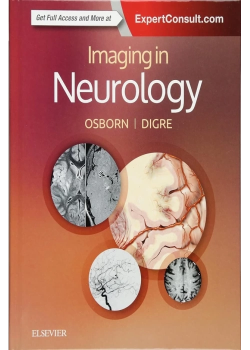 Imaging in Neurology