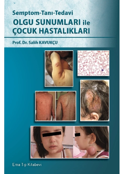 Olgu Sunumları ile Çocuk Hastalıkları Semptom-Tanı-Tedavi