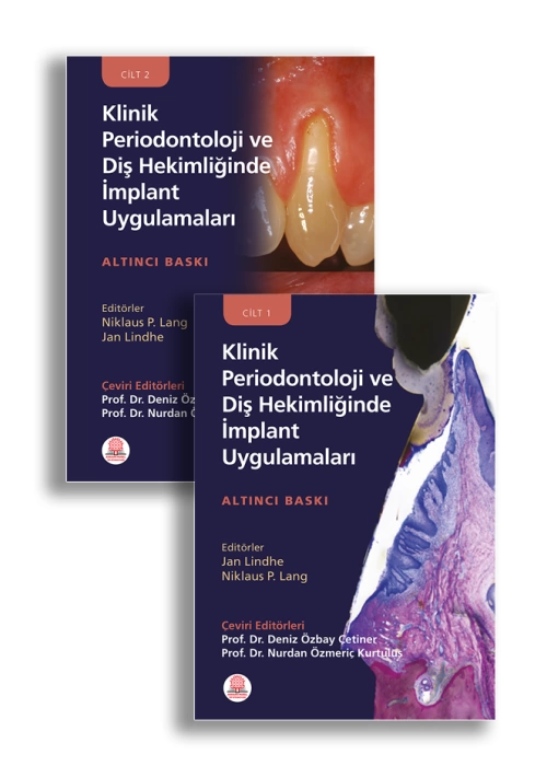 Klinik Periodontoloji ve Diş Hekimliğinde İmplant Uygulamaları