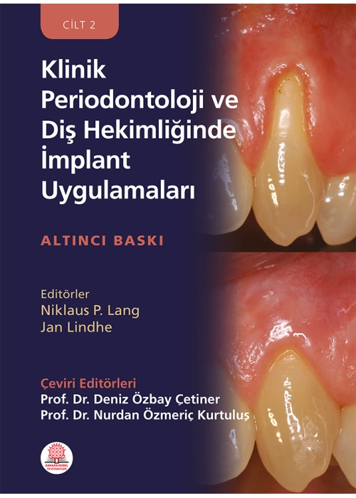 Klinik Periodontoloji ve Diş Hekimliğinde İmplant Uygulamaları