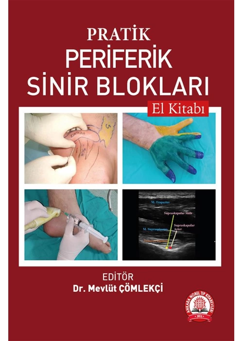 Pratik Periferik Sinir Blokları El Kitabı