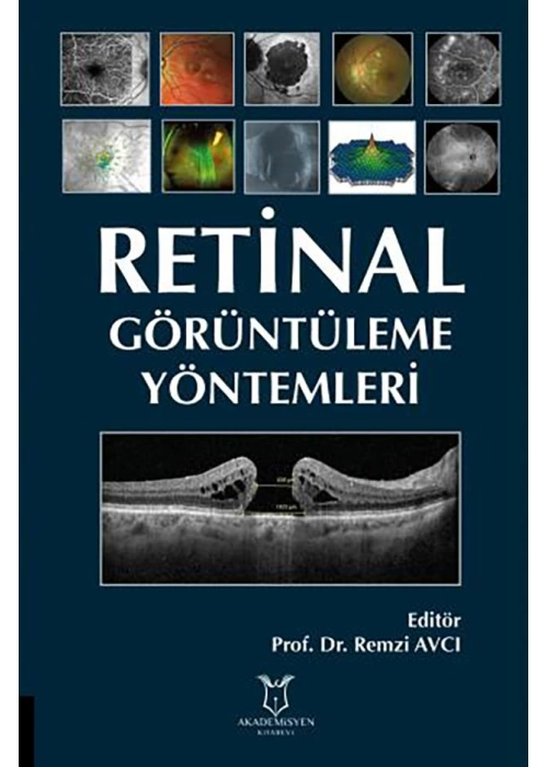 Retinal Görüntüleme Yöntemleri