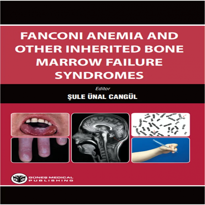 Fanconi Anemia And Other Inherited Bone Marrow Failure Syndromes