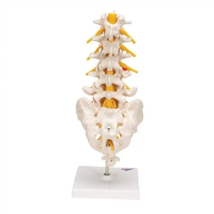 A76/5 Bel Omurga Sütunu, Dorso-Lateral Prolapsed Intervertebral Disk, 34 cm Yükseklik