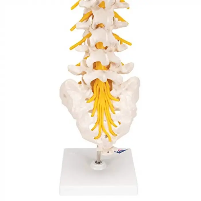 A76/5 Bel Omurga Sütunu, Dorso-Lateral Prolapsed Intervertebral Disk, 34 cm Yükseklik