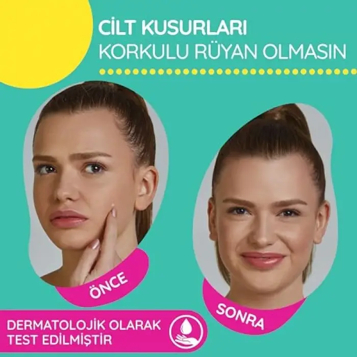 Akne Bandı Mixy Sos, 24 Parça