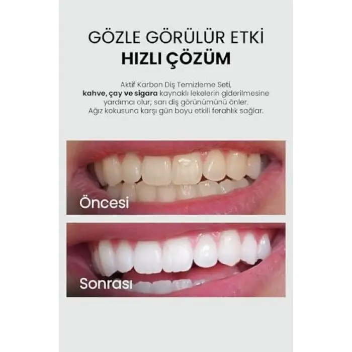 Aktif Karbon Diş Beyazlatma Macunu 75 ml