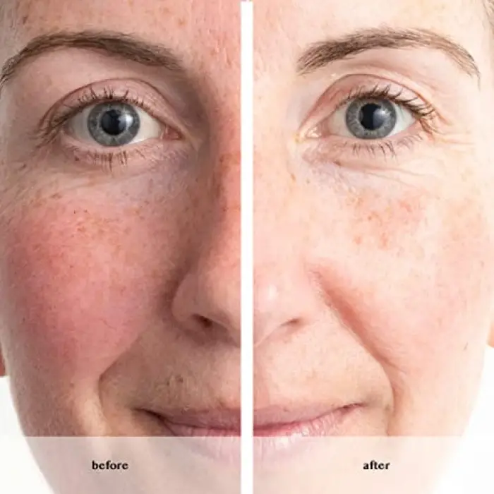 Anew Renewal Power Serum 30 Ml.