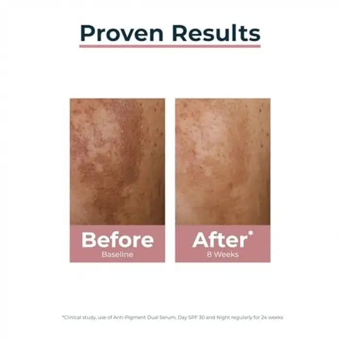 Anti Pigment Dual Serum 30ML