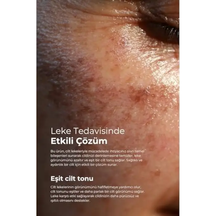 Clinic Leke Kremi 75Ml + Dermodicos Plus Krem 30Ml