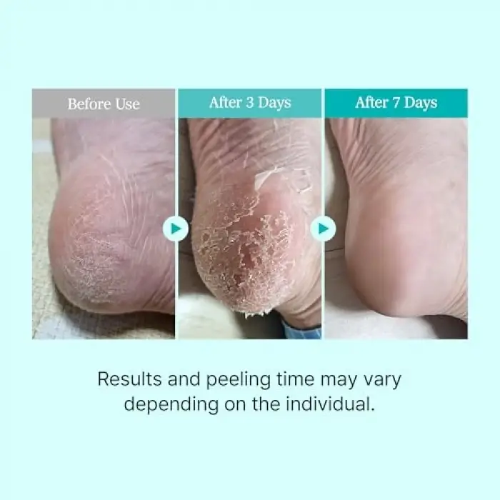 Çorap Tipi Deri Yumuşatan Ayak Peeling Maskesi, 2 Çift