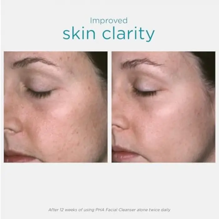 Facial Cleanser