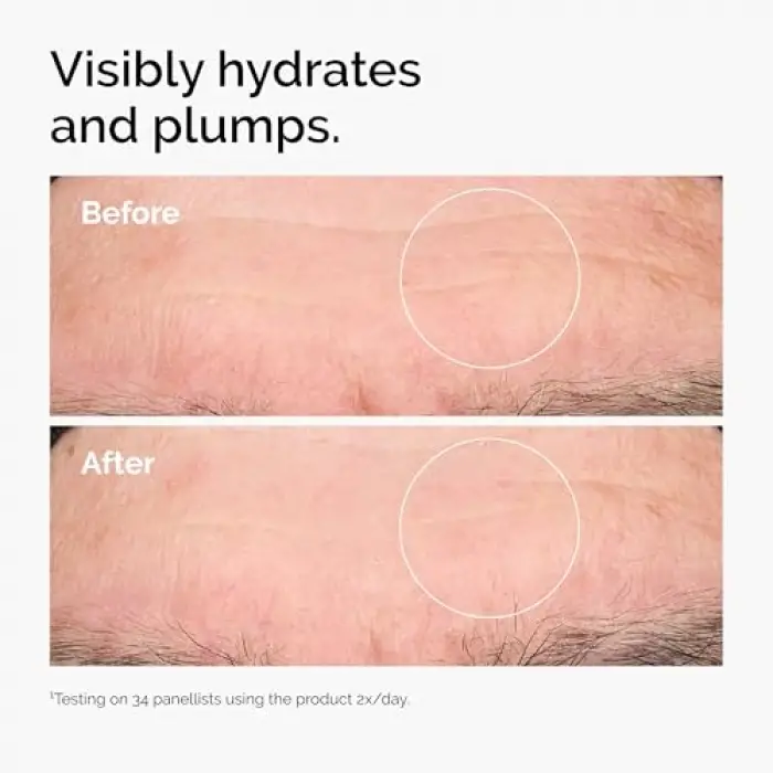 Hyaluronic Acid 2% + B5 30 ml