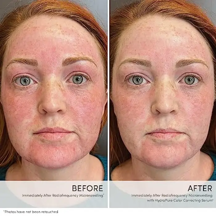 HydroPure Color Correcting Serum