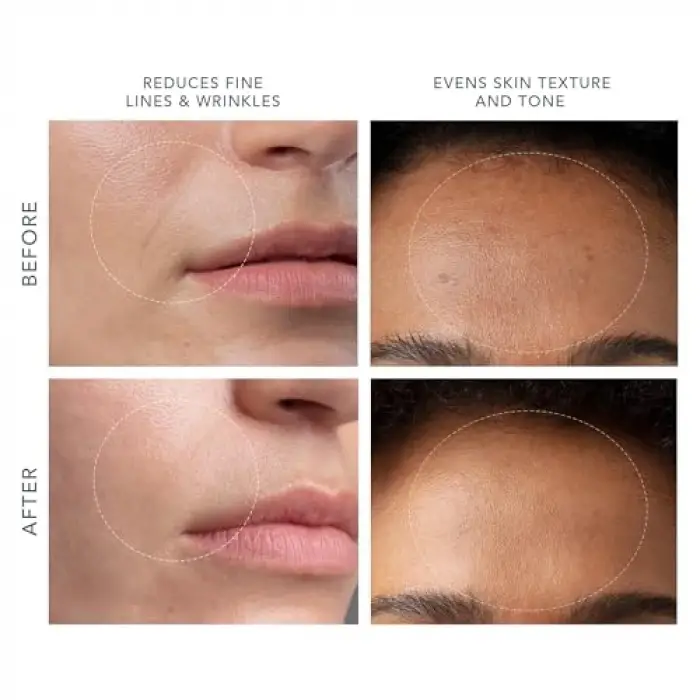 Kıwı Derma