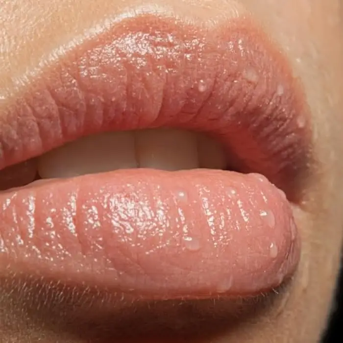 Lip Treat Dudak Balmı 10 ml