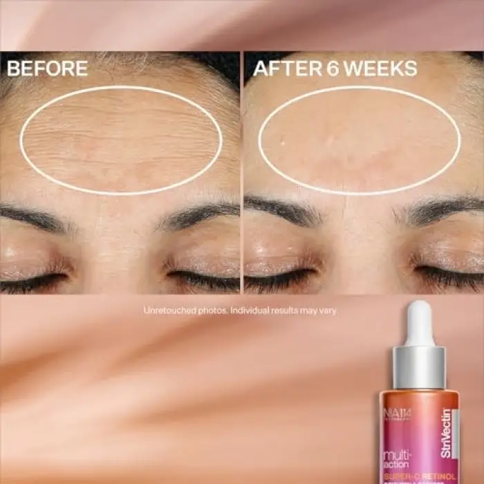 Multi Action Super C Vitamin C Retinol Brightening & Correcting Face Serum