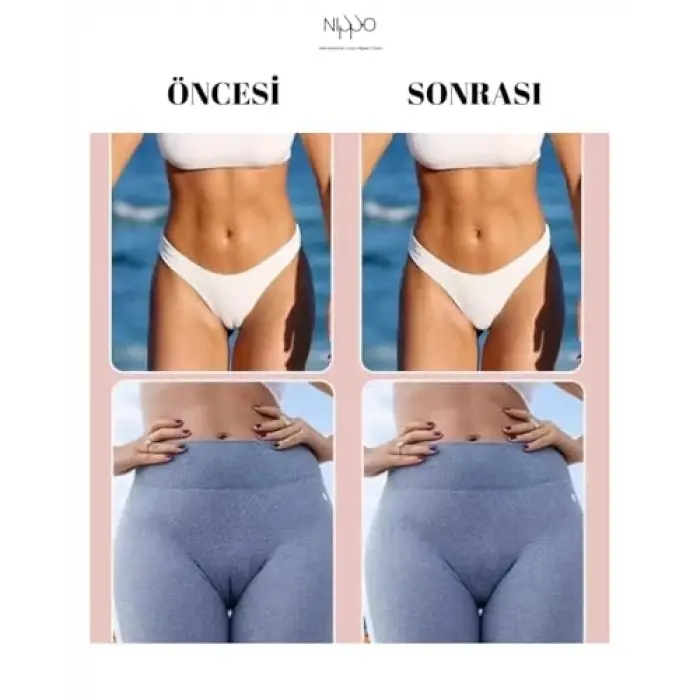 Nippo Genital Bölge Kapatıcı