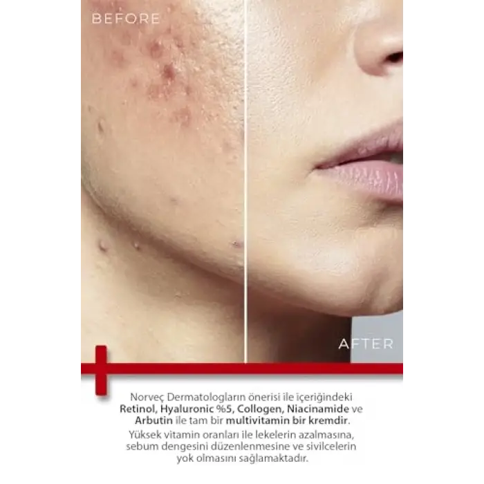 Onarıcı Krem 100ml
