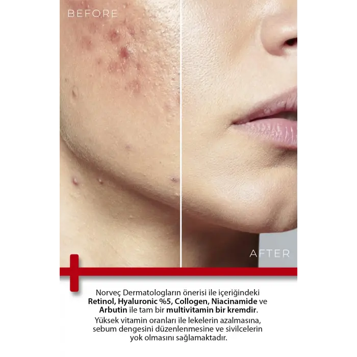 Onarıcı Krem 100ml