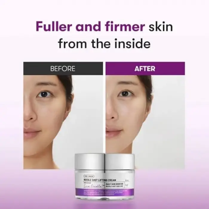 Reedle Shot Lifting Cream