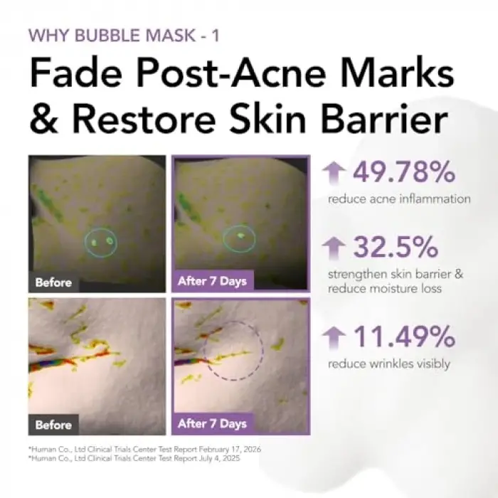 Repair 30 Seconds Quick Bubble Maske