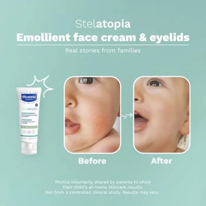 Stelatopia Emollient Yüz Kremi (40ml)