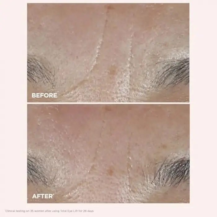 Total Eye Lift Göz Kremi 15 ml