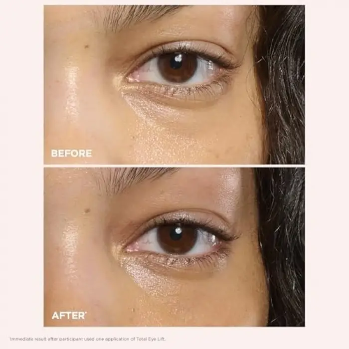 Total Eye Lift Göz Kremi 15 ml