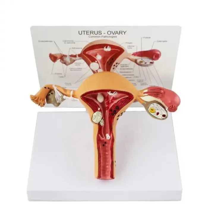 Uterus Pelvik Taban Maketi Model 41 | Uterus Pelvik Taban Maketi