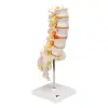 A76/5 Bel Omurga Sütunu, Dorso-Lateral Prolapsed Intervertebral Disk, 34 cm Yükseklik