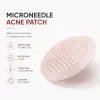 Acne Patch Collection (Mikro)