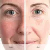 Anew Renewal Power Serum 30 Ml.