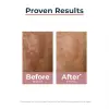 Anti Pigment Dual Serum 30ML