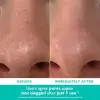 Even Smoother™ Mikrodermabrazyon Peeling Gözenek Arıtıcı